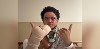 North Shore Lifeguard Hospitalized in Brutal Beach Assault