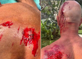 Shane Dorian Got Turned Into Hamburger by an Indonesian Reef