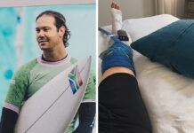Jordy Smith Underwent Two Surgeries, Remains Out of Competition